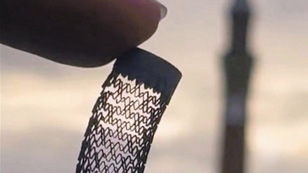 stent - pic preside.jpg 1