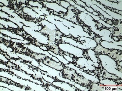 [ Etched micrograph of sigma phase formation (dark phases) in a super duplex stainless steel