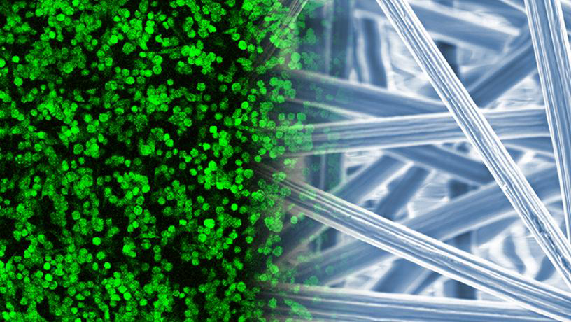 Live cells (left) fabricate a biologically relevant extracellular matrix on electrospun fibres (right) for tissue regeneration