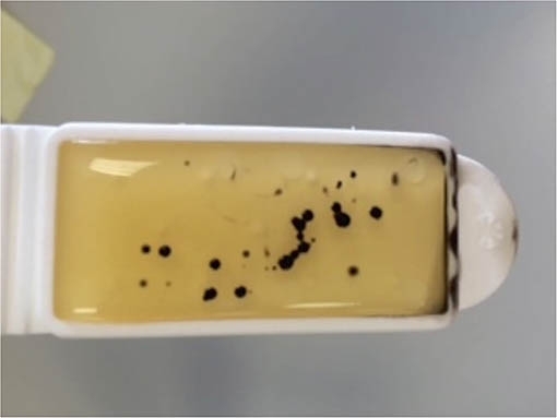 Cultured dipslide used to sample the bacterial burden of a high-touch surface in a hospital ward
