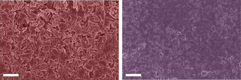 Microstructural growth in a lithium battery