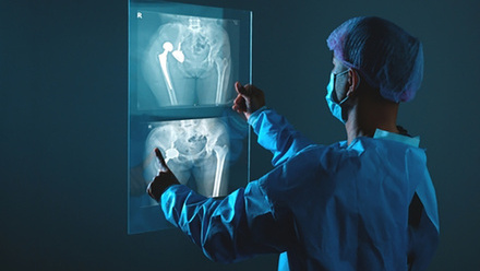 X-ray_shutterstock_2438250489.jpg