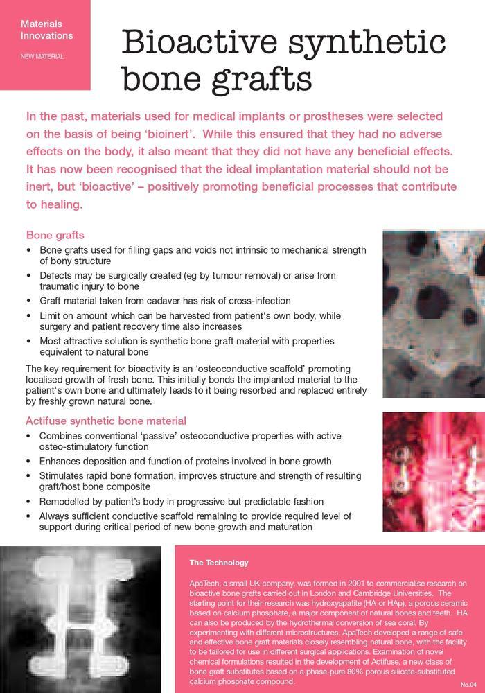 Image of poster exploring bioactive bone grafts