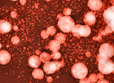 shutterstock_302928620-Gold nanoparticles produced by laser sputtering in water.jpg