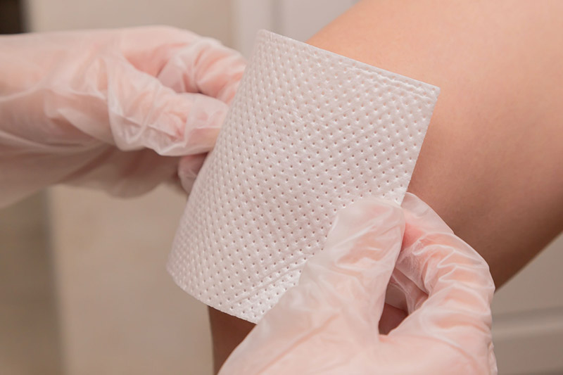 wound dressing