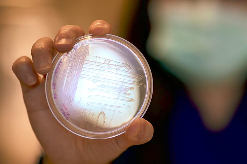 ZD1 in agar