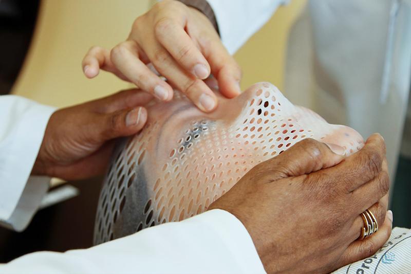 The hands of two radiation therapists are shown fitting a short face mask to a patient model to steady the head during radiation therapy