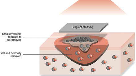 USE THIS IMAGE surgical_dressing_illustration_final credit to Paul Molde - RGB.jpg