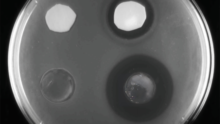 bacterial culture for website.png