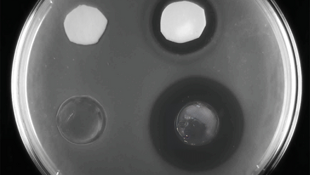 bacterial culture for website.png