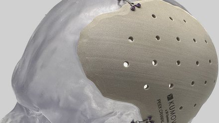 Cranial_Implant resized for web.png